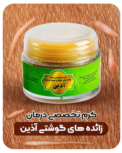 کرم تخصصی درمان زائدهای گوشتی اضافه بعد از عمل آذین سیمرغ خاورمیانه