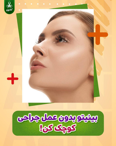 ژل کوچک کننده بینی آذین